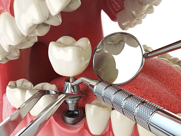 Best Cosmetic Emergency Dentistry in Waverly, NY